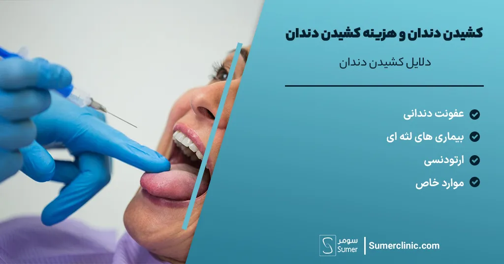 دلایل کشیدن دندان