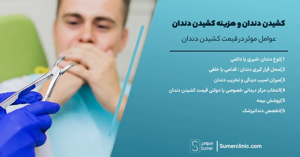 عوامل موثر در قیمت کشیدن دندان