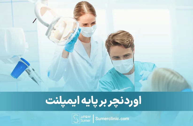 اوردنچر بر پایه ایمپلنت