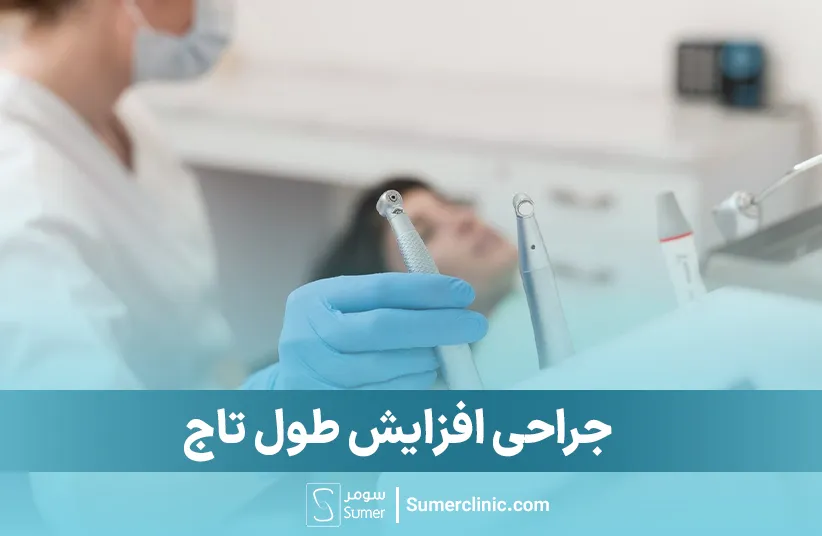 جراحی افزایش طول تاج