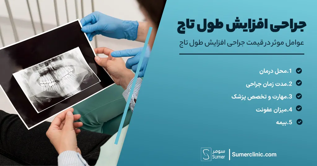 عوامل موثر در قیمت جراحی افزایش طول تاج