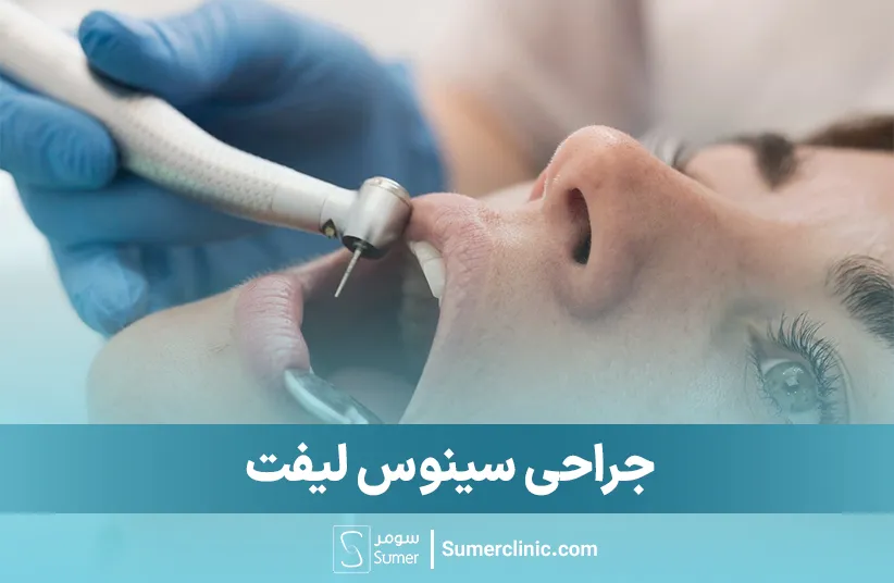جراحی سینوس لیفت