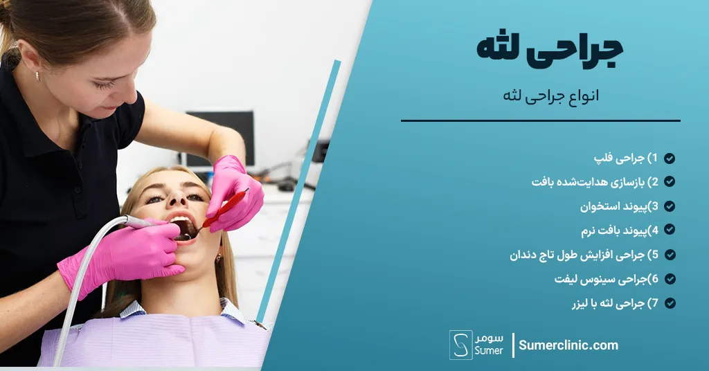 انواع جراحی لثه