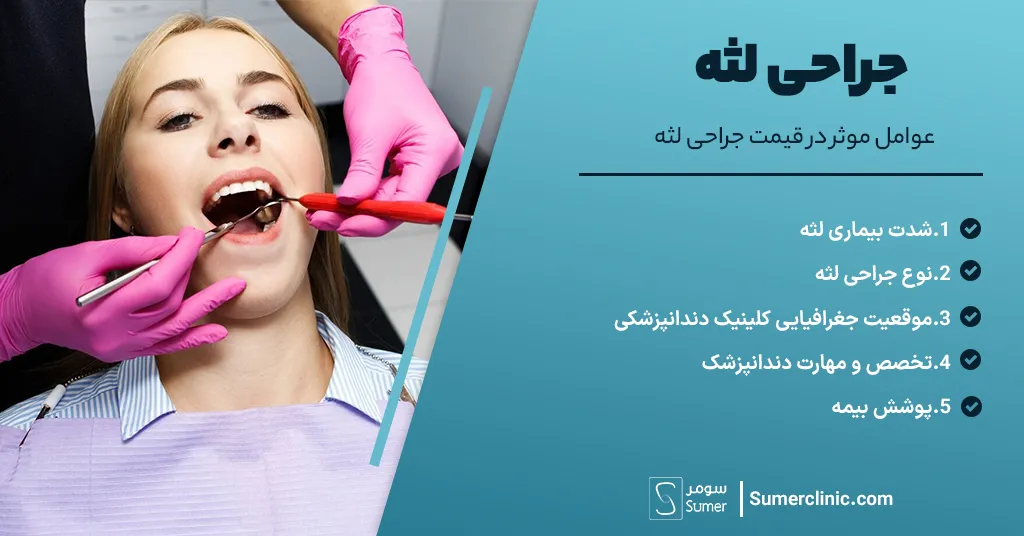 عوامل موثر در قیمت جراحی لثه