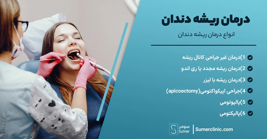 انواع درمان ریشه دندان