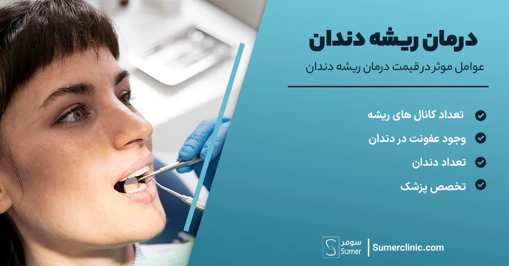 عوامل موثر در قیمت درمان ریشه دندان