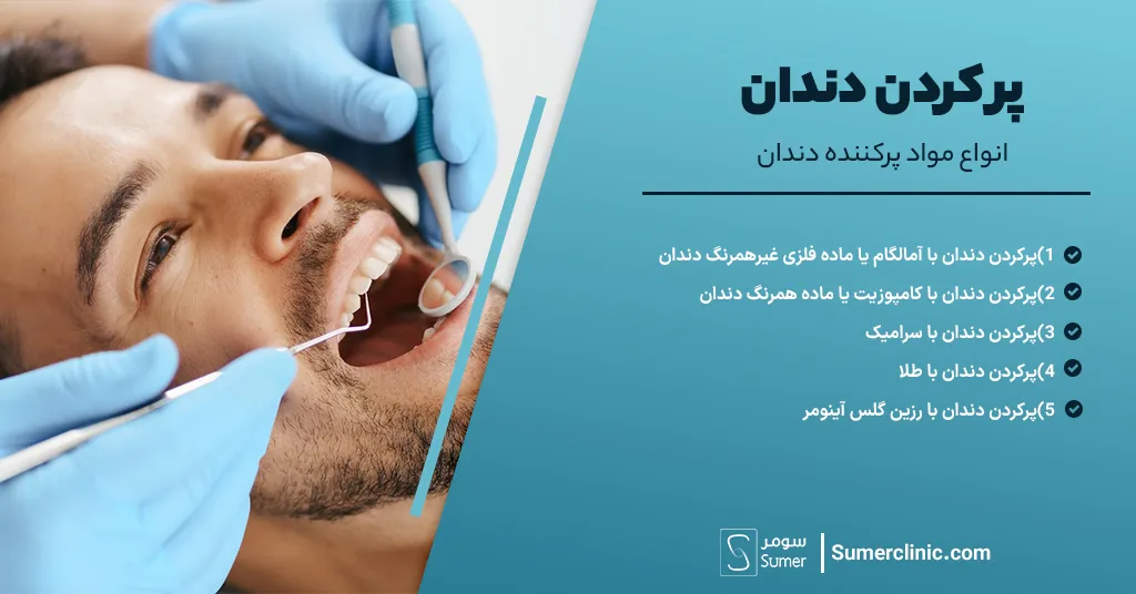 بررسی انواع مواد پر کننده دندان 