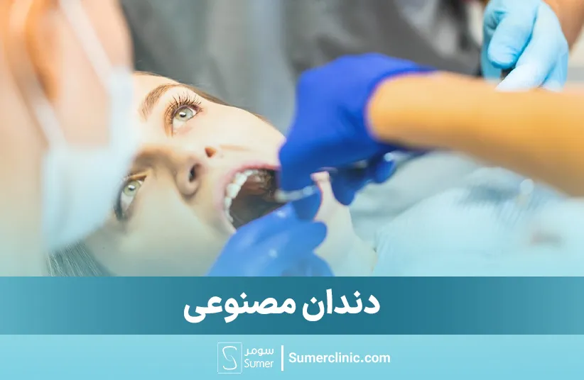 دندان مصنوعی