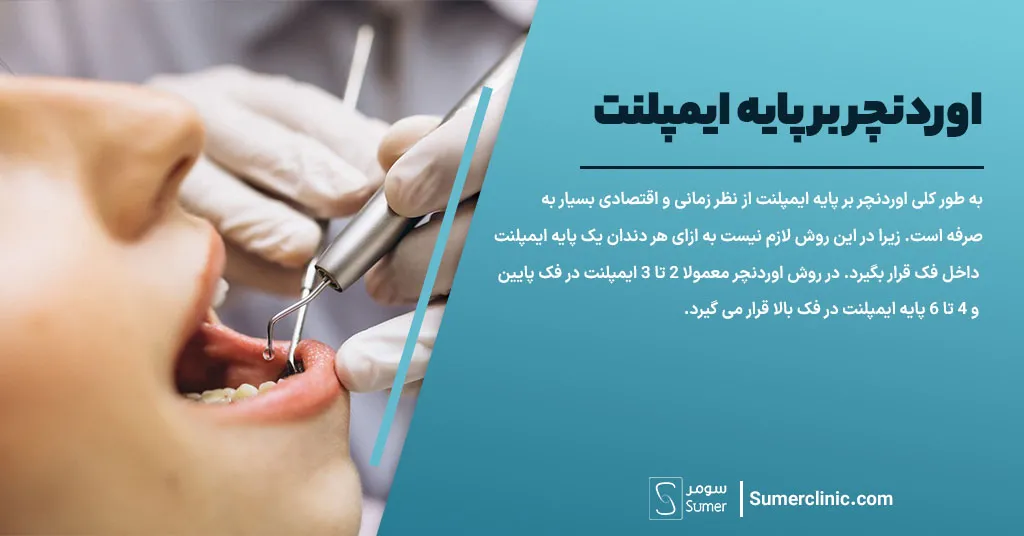 اوردنچر چیست؟