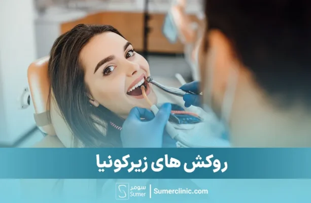 روکش دندان زیرکونیا