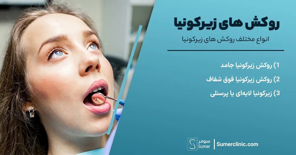 بررسی انواع روکش دندان زیرکونیا