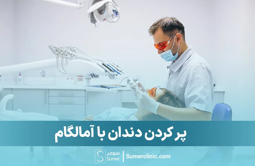 پرکردن دندان با آمالگام