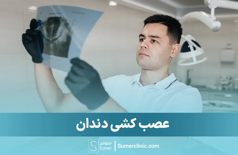 عصب کشی دندان