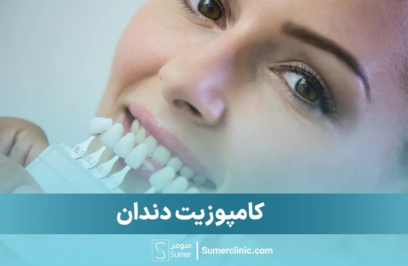کامپوزیت دندان