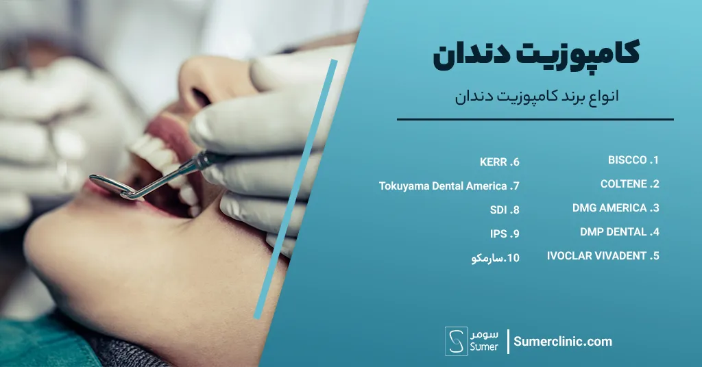 انواع برند کامپوزیت دندان