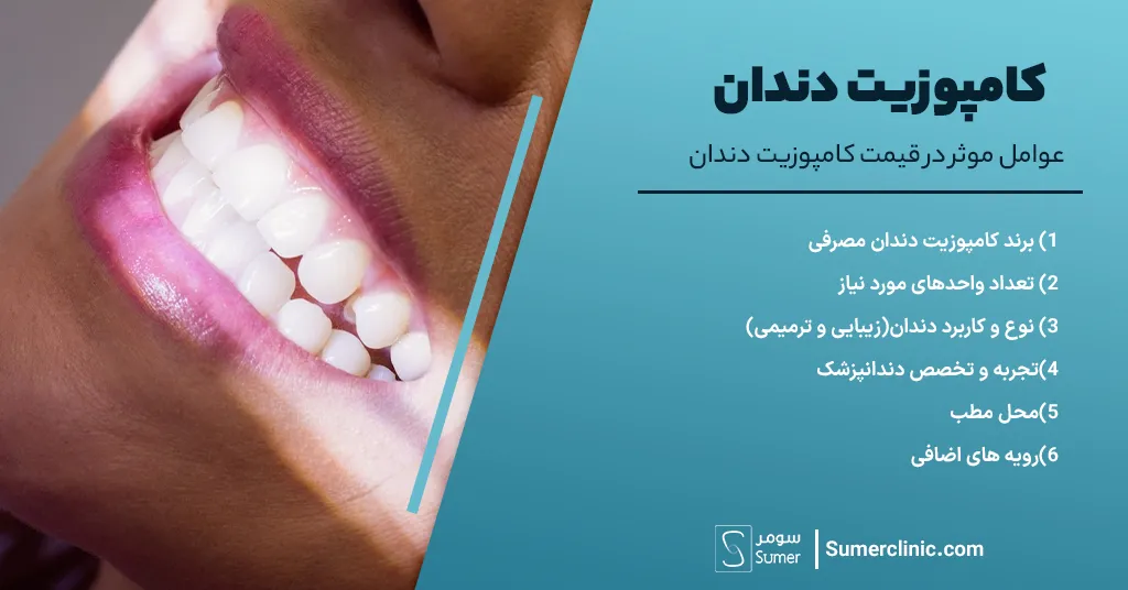 عوامل موثر در قیمت کامپوزیت دندان