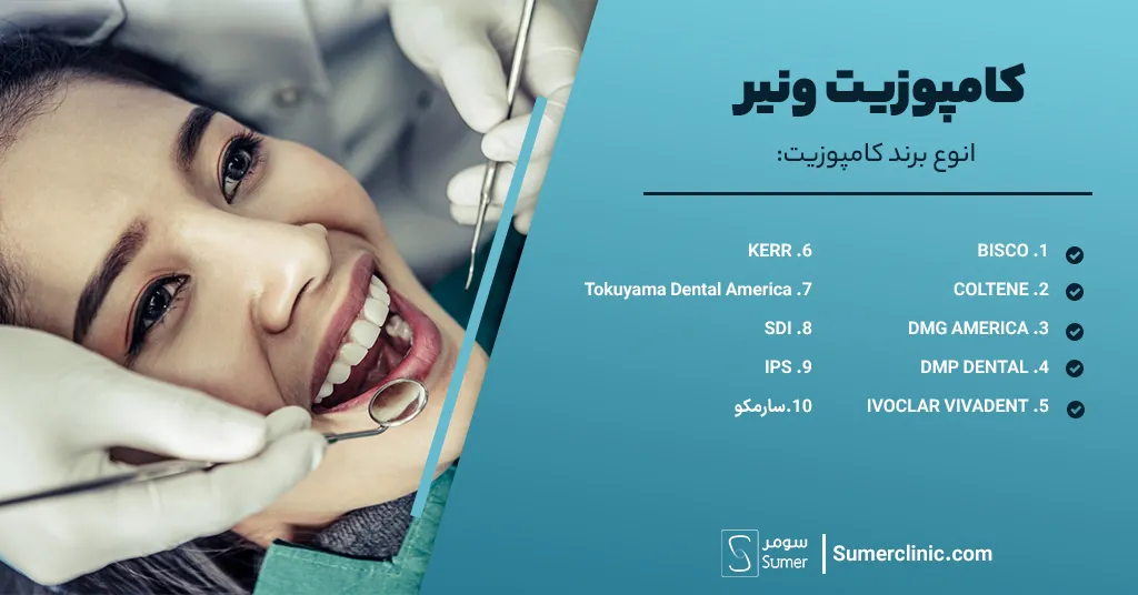 نوع و برند کامپوزیت