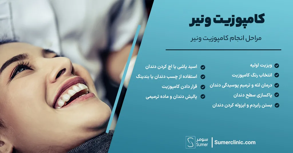 مراحل انجام کامپوزیت ونیر