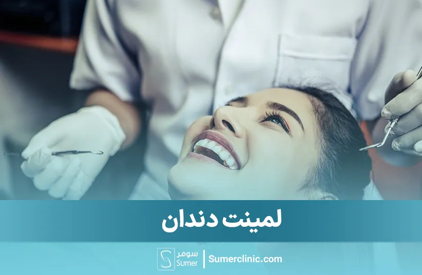 لمینت دندان