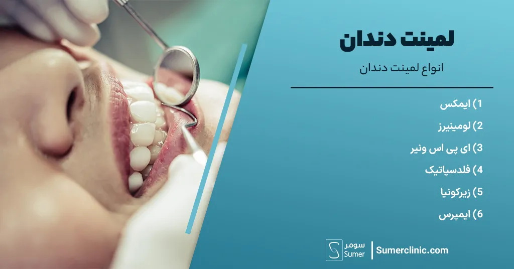 انواع لمینت دندان 