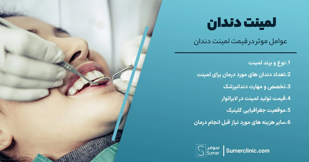 عوامل موثر در قیمت لمینت دندان