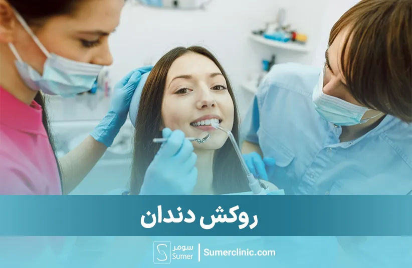 روکش دندان