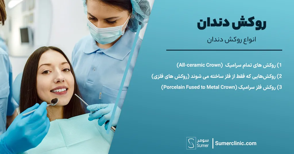 انواع روکش دندان