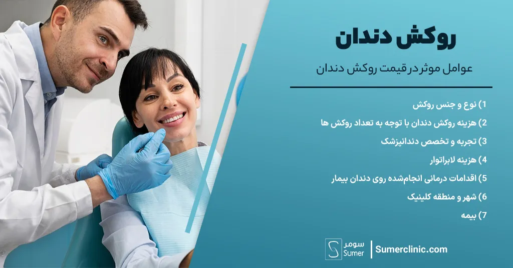 عوامل موثر در قیمت روکش دندان