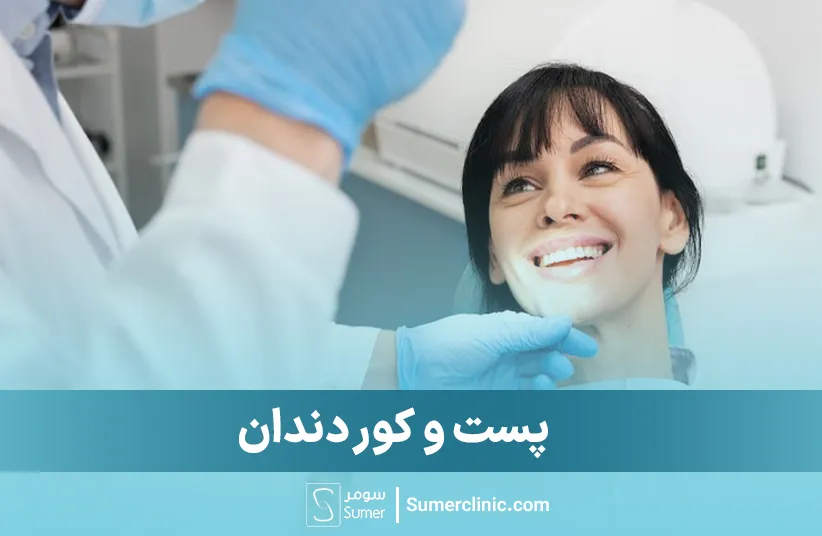 پست و کور دندان