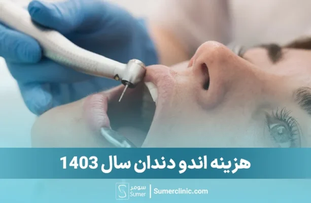 اندو دندان