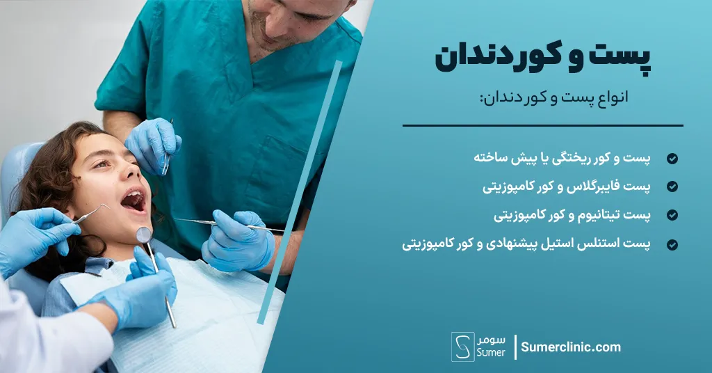 انواع پست و کور دندان