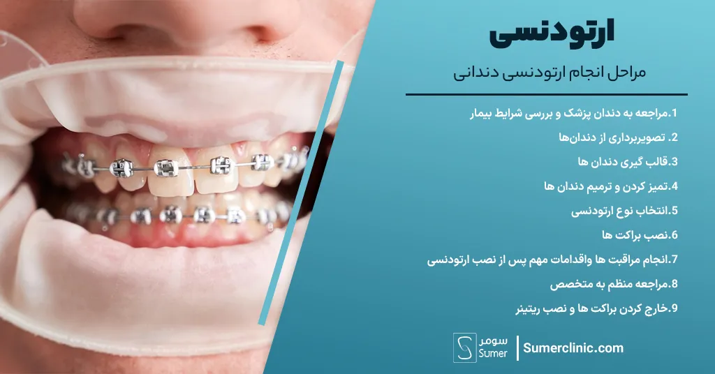 مراحل ارتودنسی