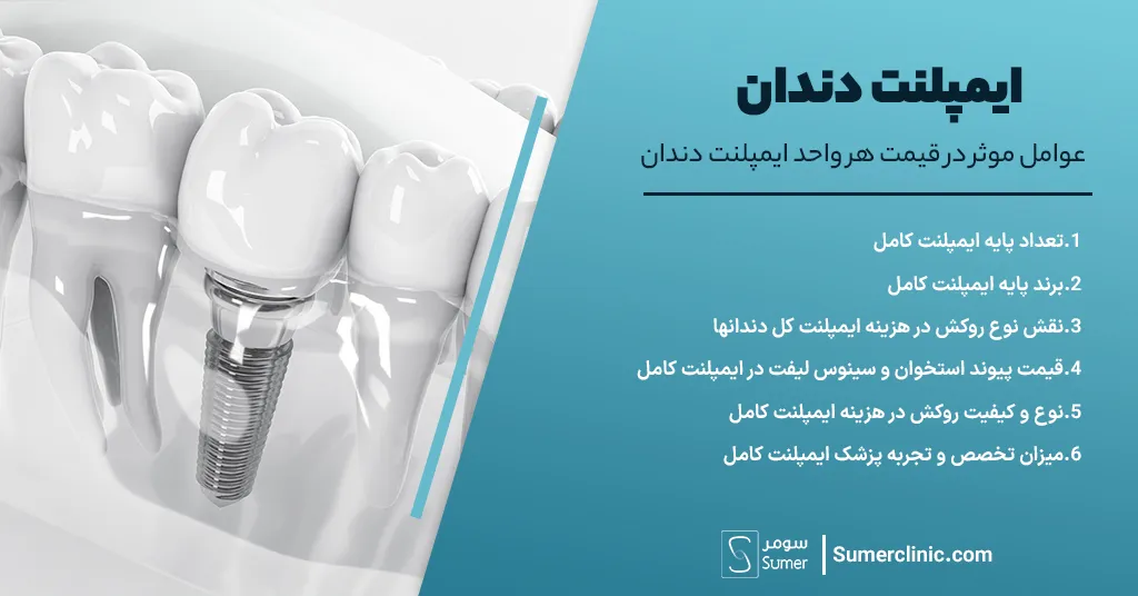 عوامل موثر در قیمت هر واجد ایمپلنت