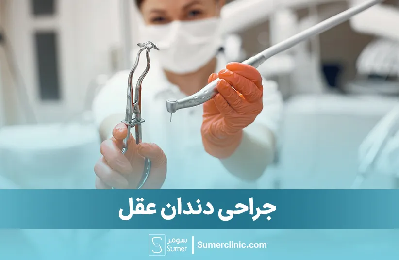 جراحی دندان عقل