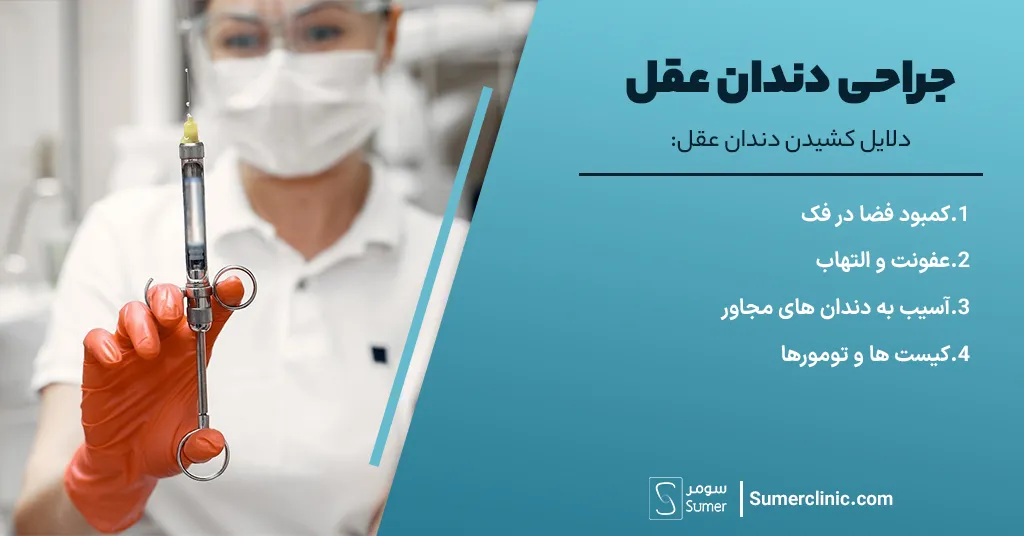 دلایل جراحی دندان عقل