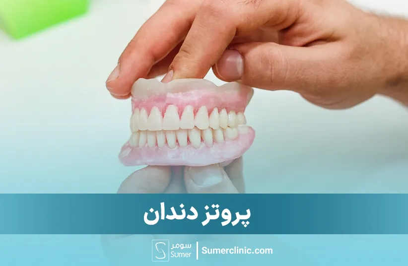 پروتز دندان