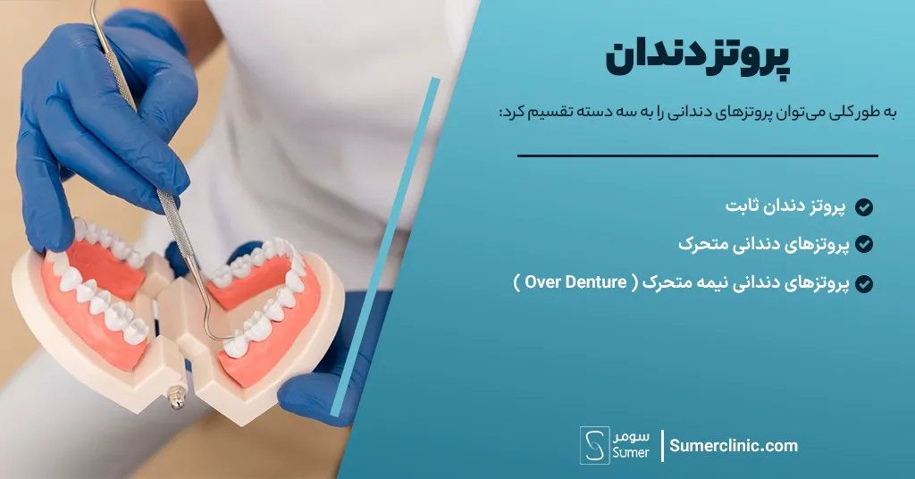 انواع پروتز دندان