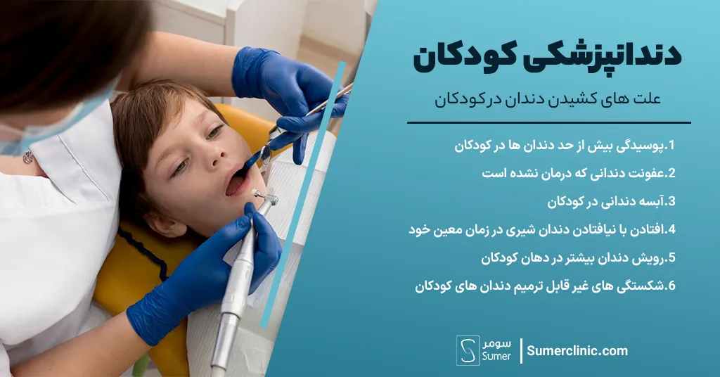 علت کشیدن دندان در کودکان