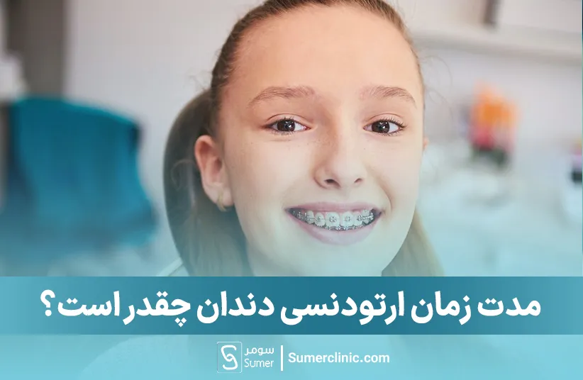 مدت زمان ارتودنسی
