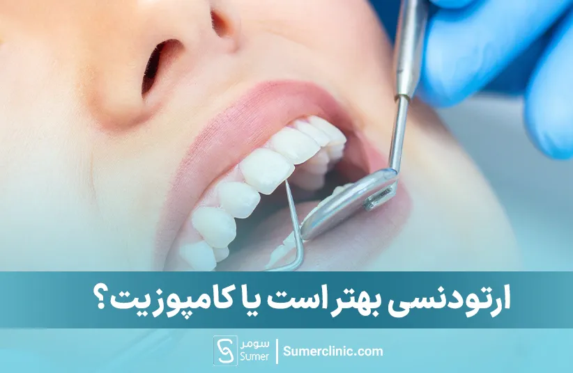 ارتودنسی بهتر است یا کامپوزیت؟