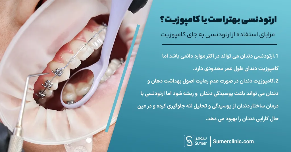 مزایای استفاده از ارتودنسی به جای کامپوزیت