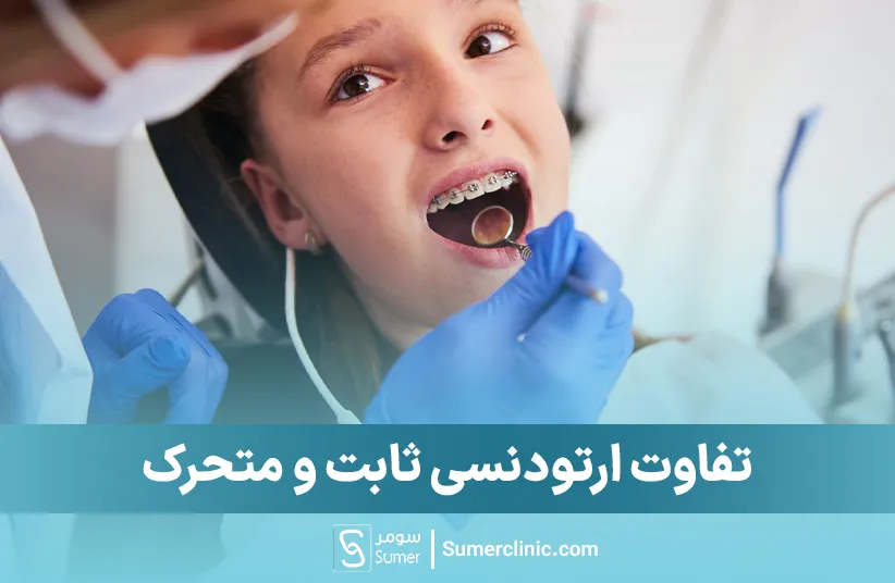 تفاوت ارتودنسی ثابت و متحرک