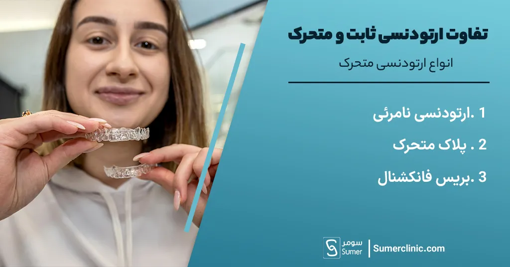 انواع ارتودنسی متحرک