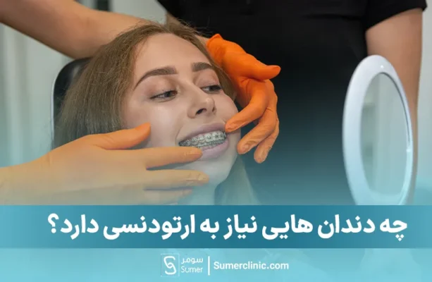 چه دندان هایی نیاز به ارتودنسی دارد؟