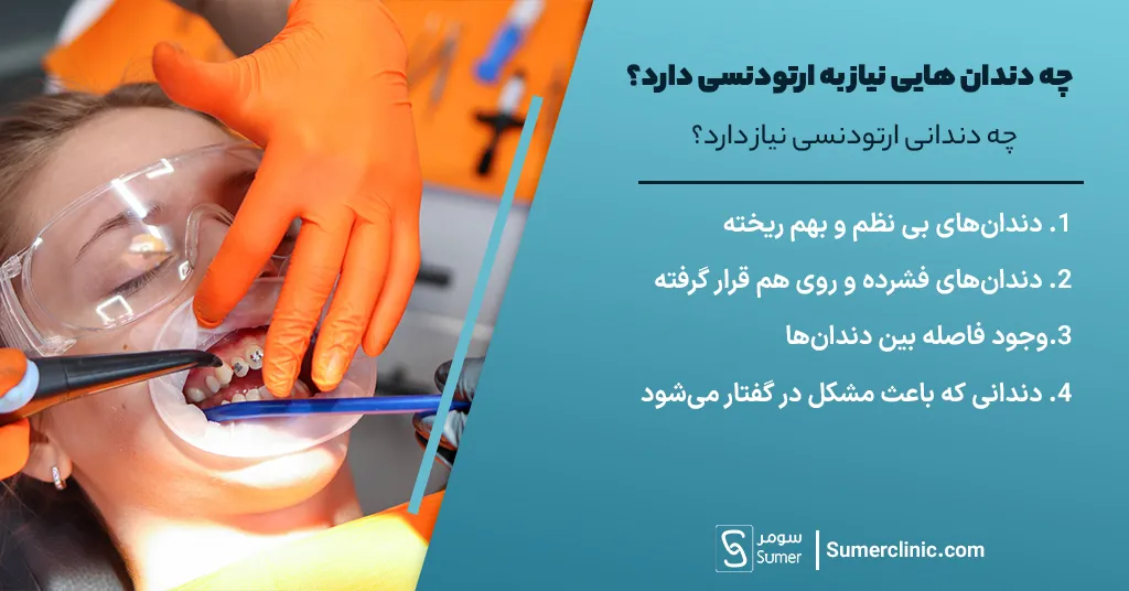 چه دندانی ارتودنسی نیاز دارد؟