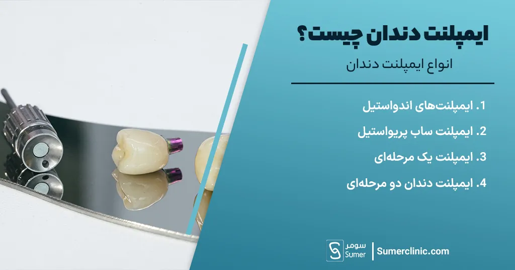انواع ایمپلنت دندان