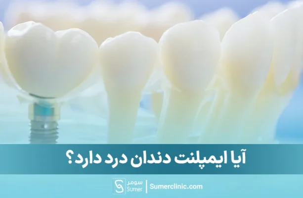 آیا ایمپلنت دندان درد دارد؟