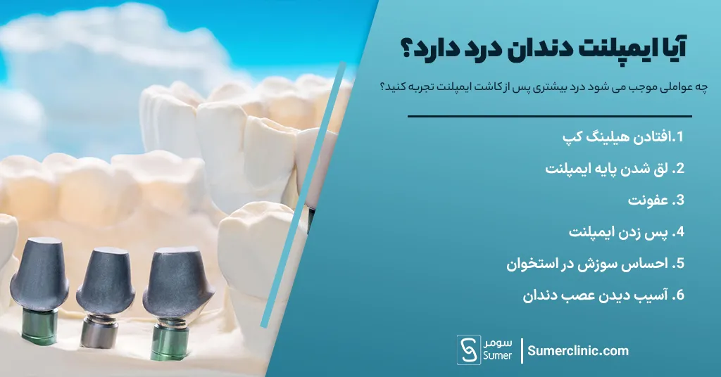 چه عواملی موجب می شود درد بیشتری پس از کاشت ایمپلنت تجربه کنید؟