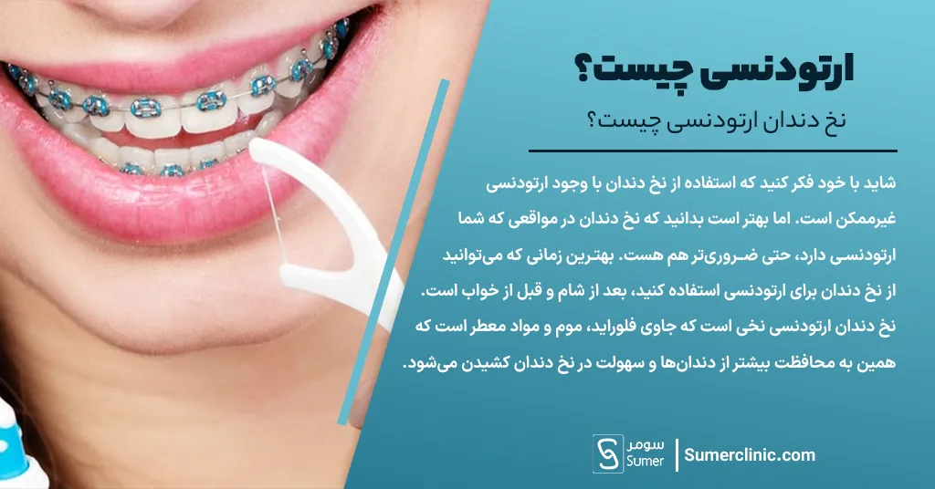 نخ دندان ارتودنسی