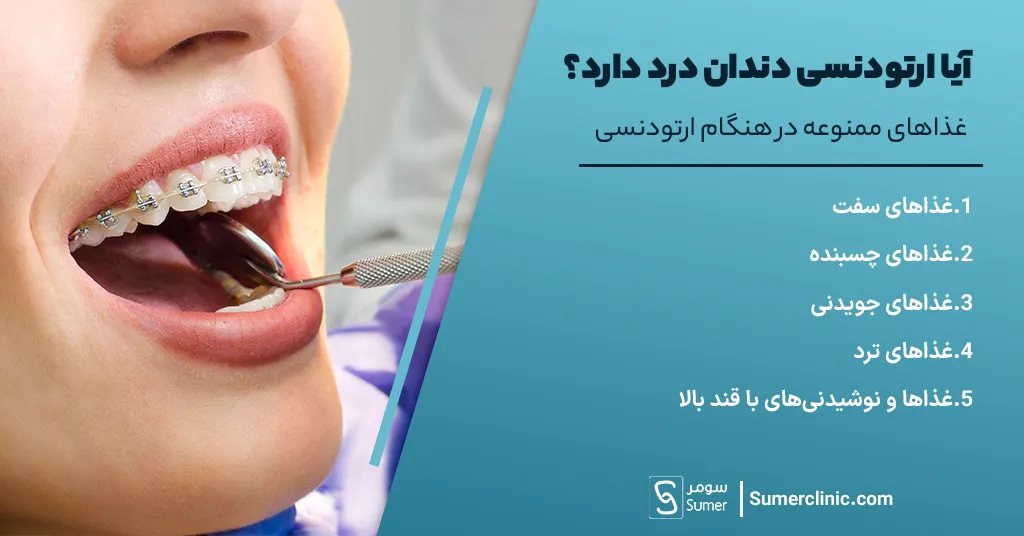 غذاهای ممنوعه در هنگام ارتودنسی